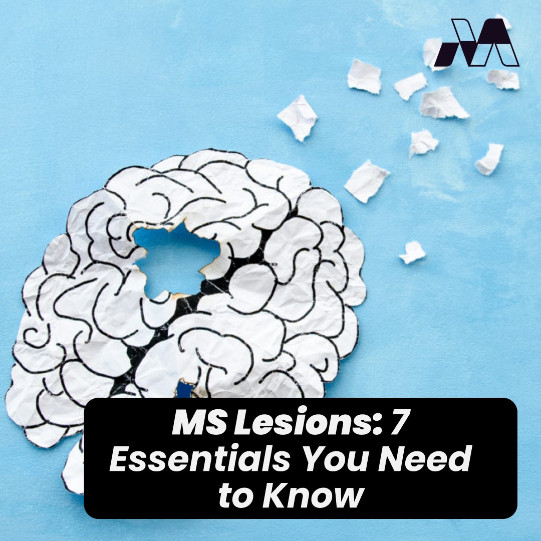 MS Lesions 4 Things You Need to Know